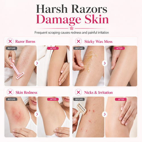 🌸 Smooth Roll-On Hair Remover – Gentle Body Hair Removal for Silky Skin